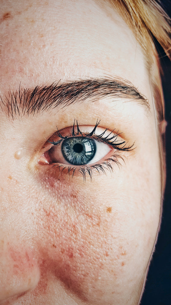 Natural Ways to Soothe Inflamed Skin